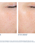 SkinBetter - AlphaRet Exfoliating Peel Pads
