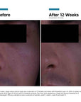 SkinCeuticals P-TIOX Anti-Wrinkle Cream