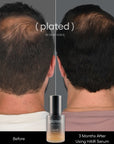 Plated - HAIR Serum