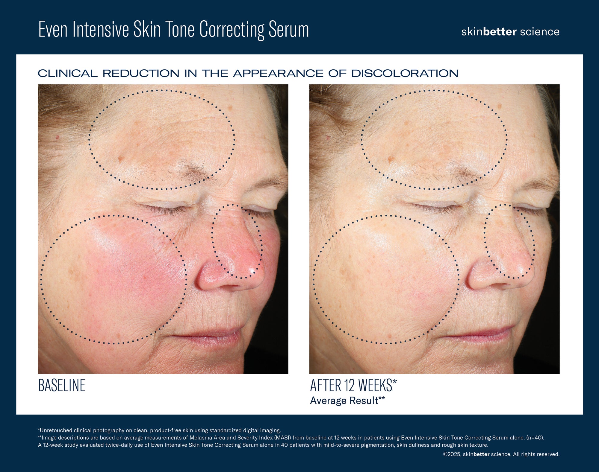 SkinBetter - Even Intensive Skin Tone Correcting Serum