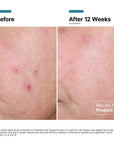 SkinCeuticals Advanced RGN-6 - 1.7 oz