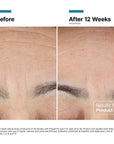 SkinCeuticals Advanced RGN-6 - 1.7 oz