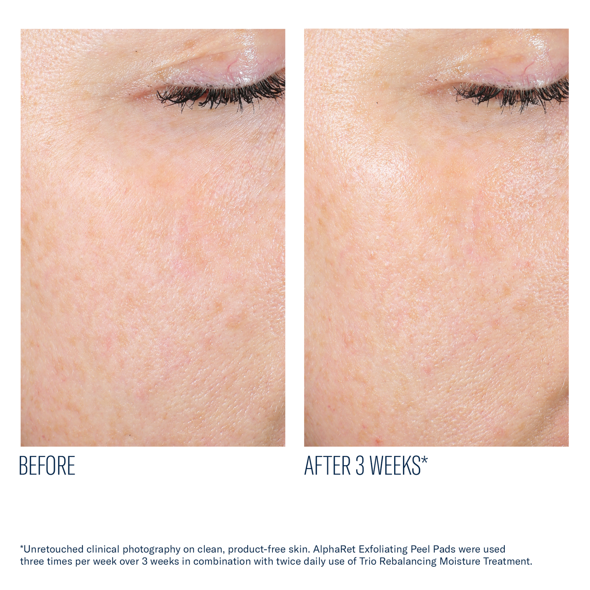 SkinBetter - AlphaRet Exfoliating Peel Pads