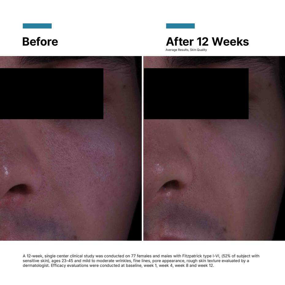 SkinCeuticals P-TIOX Anti-Wrinkle Cream