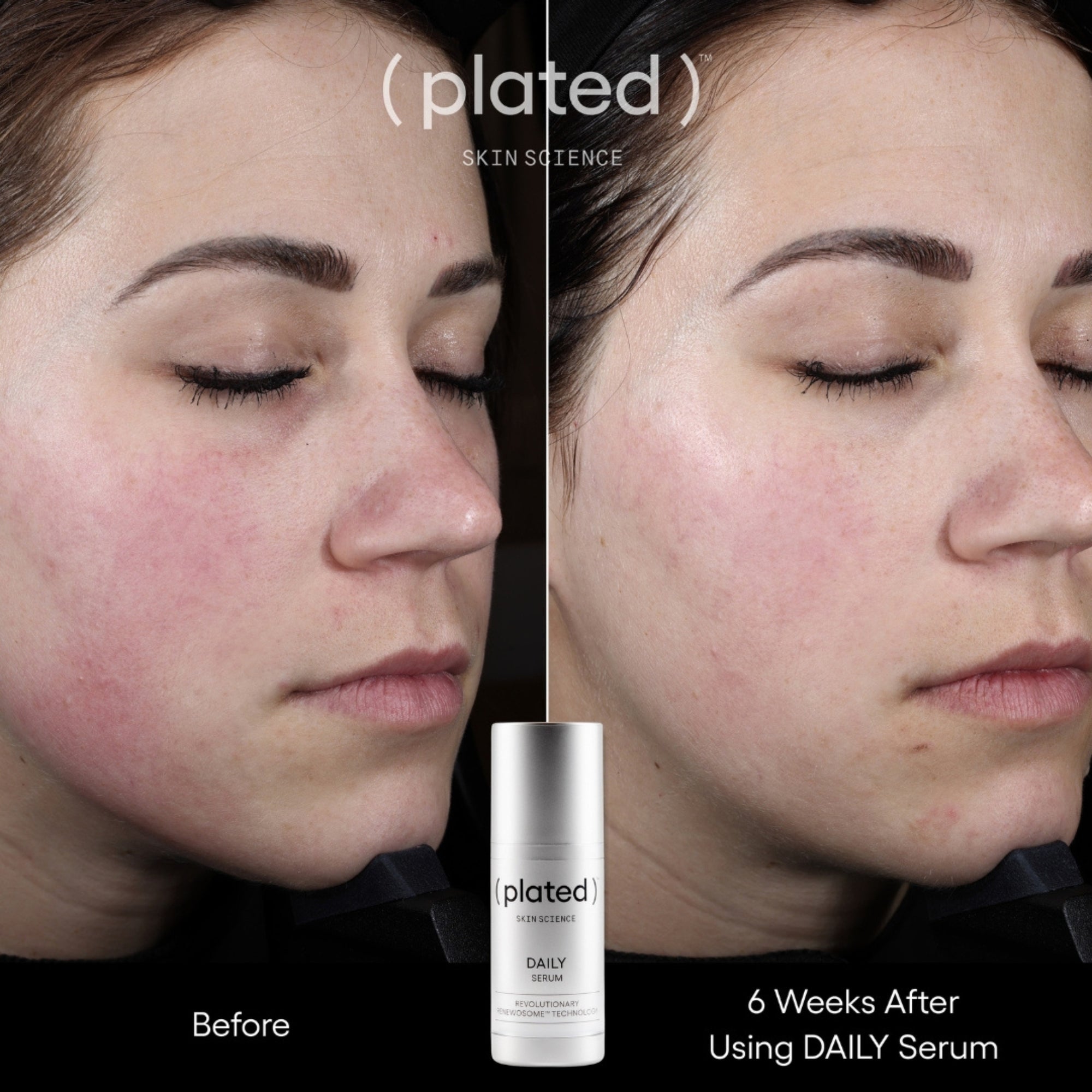 PLATED™ DAILY Serum