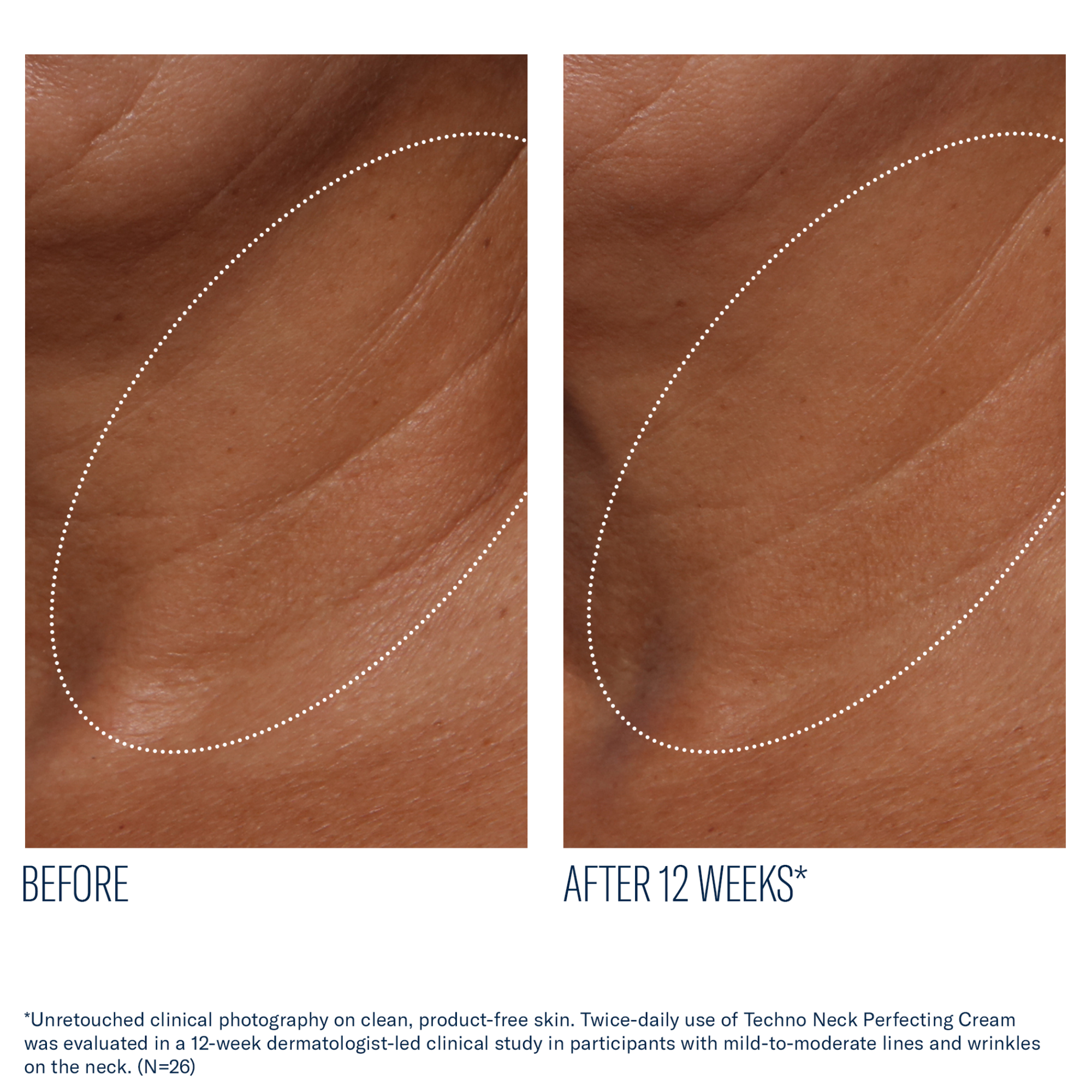 SkinBetter - Techno Neck Perfecting Cream - 1.7 oz