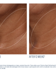 SkinBetter - Techno Neck Perfecting Cream - 1.7 oz