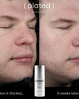 PLATED™ DAILY Serum