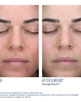 SkinBetter - AlphaRet Clearing Serum - 1 oz