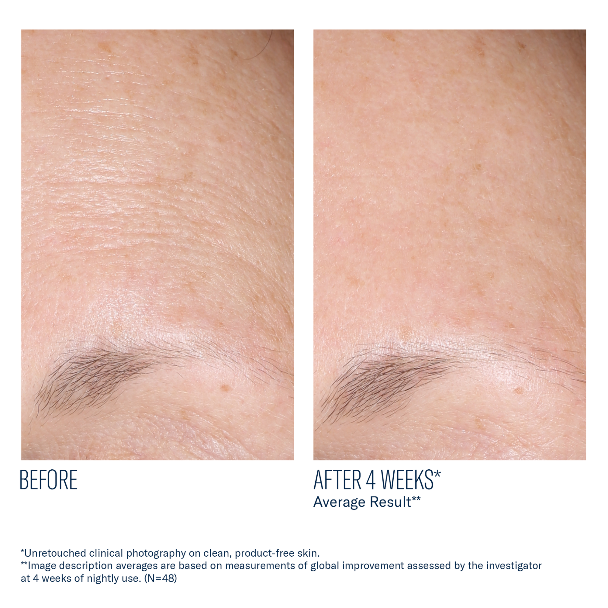 SkinBetter - AlphaRet Overnight Cream - 1 oz