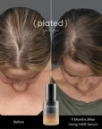 Plated - HAIR Serum