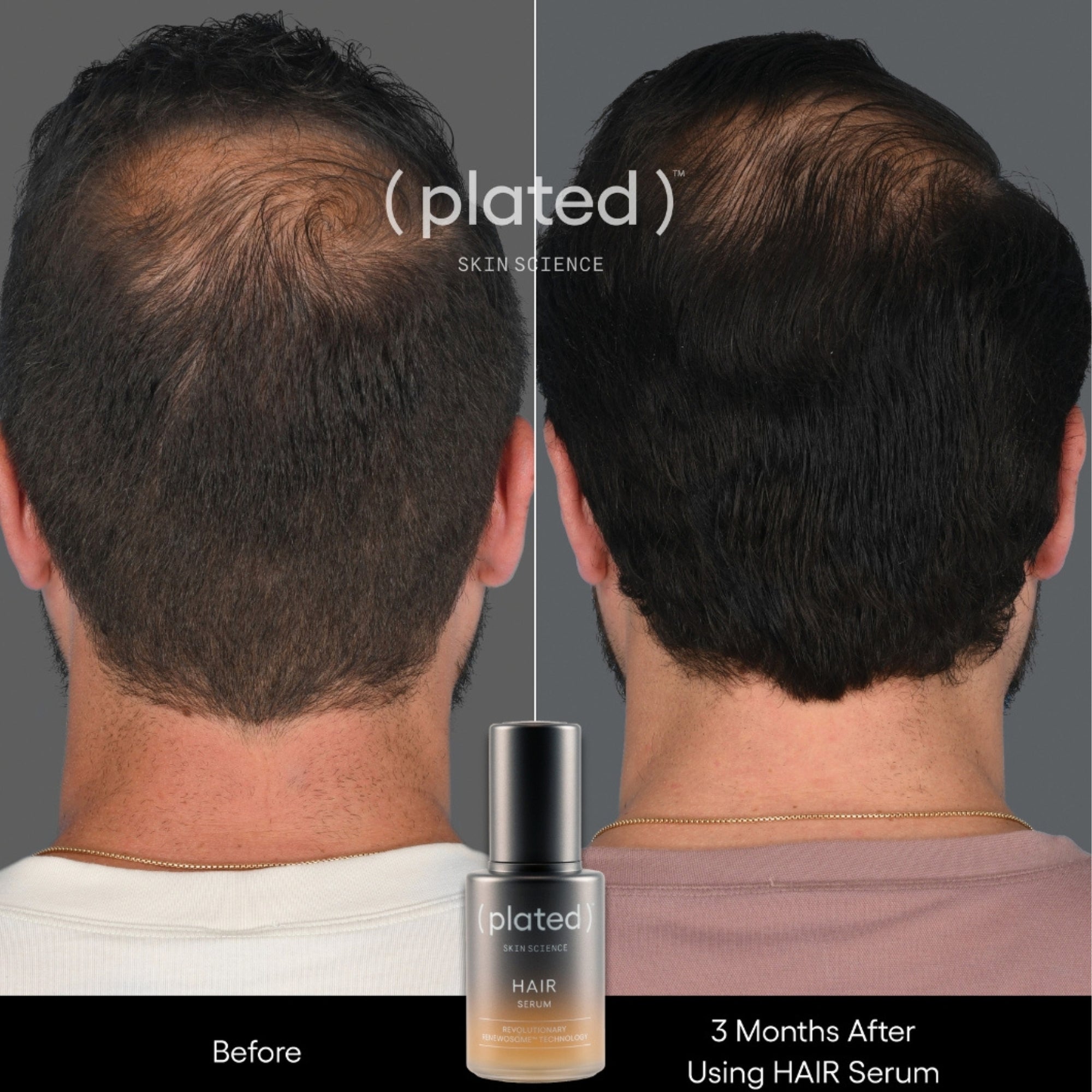 Plated - HAIR Serum