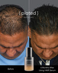 Plated - HAIR Serum