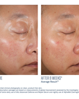 SkinBetter - A-Team Duo Kit -