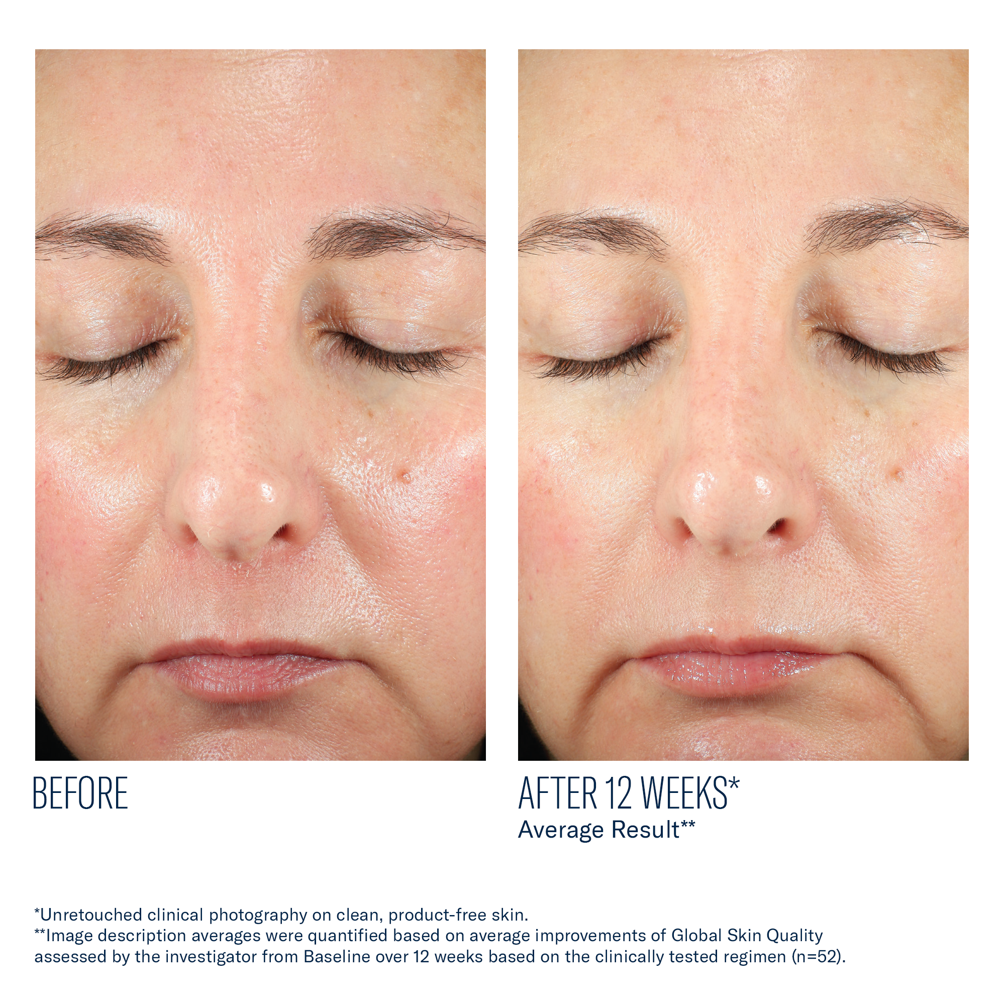 SkinBetter - BioRewind Skin Health Dietary Supplement