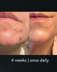 Epicutis® Hydrobiome Serum