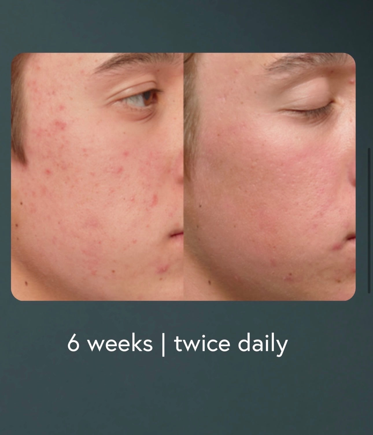 Epicutis® Hydrobiome Serum