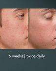 Epicutis® Hydrobiome Serum