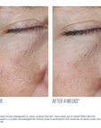 SkinBetter - Instant Effect Gel EYE - .5 oz