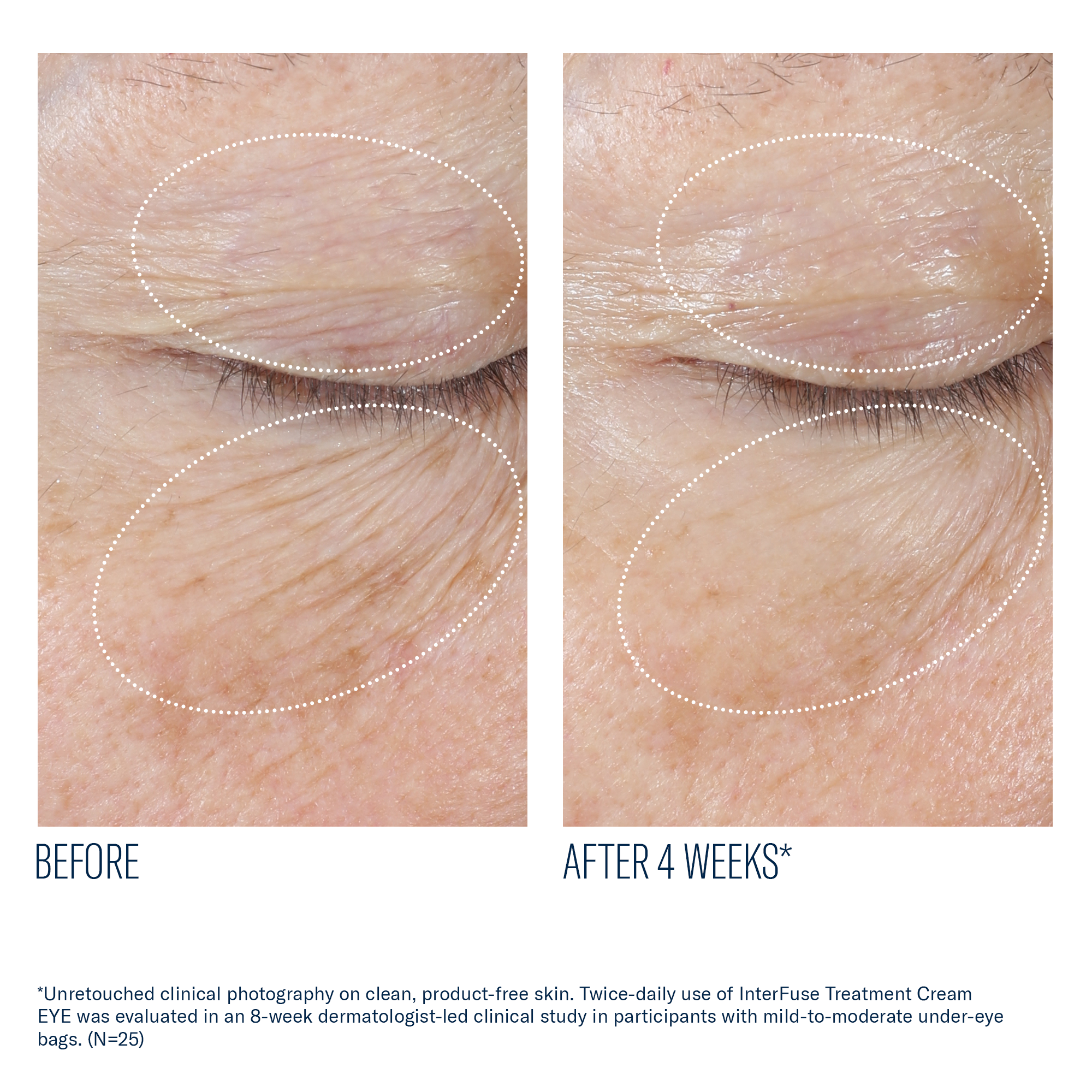 SkinBetter - InterFuse Treatment Cream EYE - .5 oz