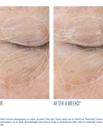SkinBetter - InterFuse Treatment Cream EYE - .5 oz