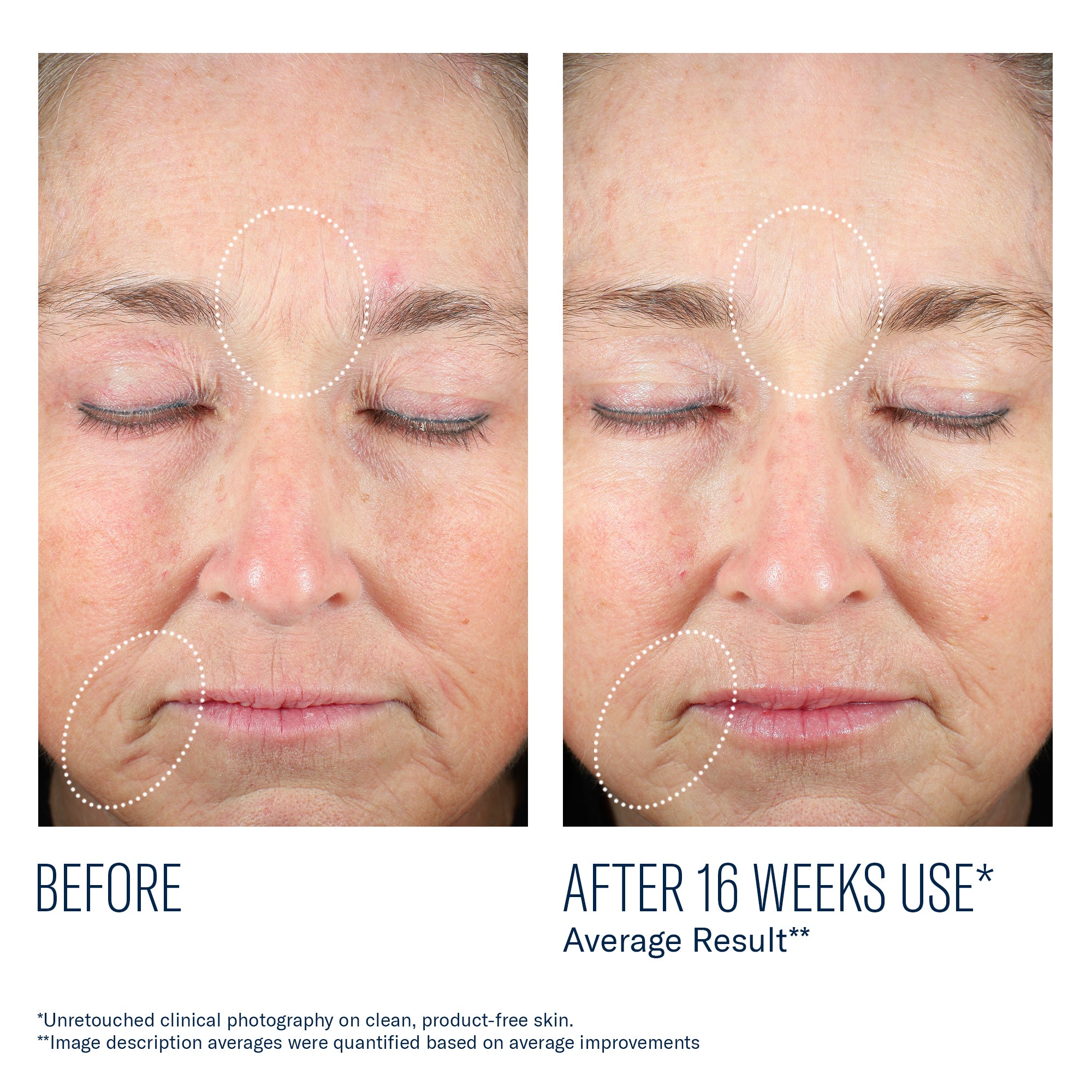 SkinBetter - Mystro Revive Renewing Serum - 1 oz