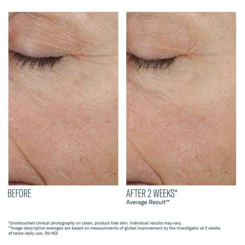 SkinBetter Trio Rebalancing Moisture Treatment