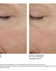 SkinBetter Trio Rebalancing Moisture Treatment