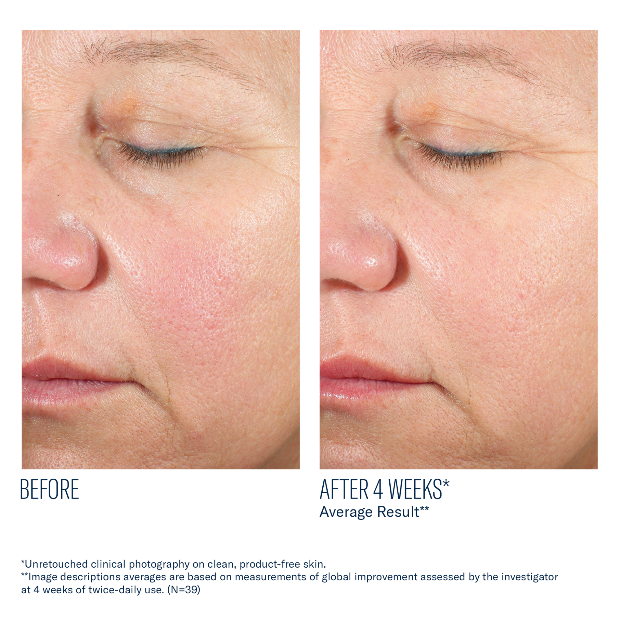 SkinBetter - Alto Advanced Defense and Repair Serum - 1 oz