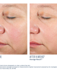 SkinBetter - Alto Advanced Defense and Repair Serum - 1 oz