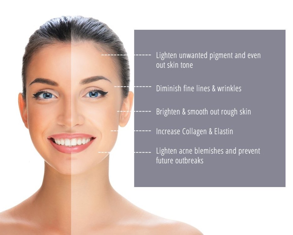 Peels Staci Christie Skin peels-staci-christie-skin